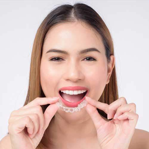 Dental Braces: Types, Care, What To Expect - Miami Orthodontist Group