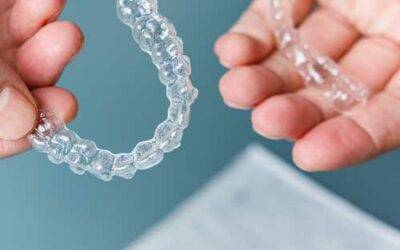 Why Invisalign is better than braces