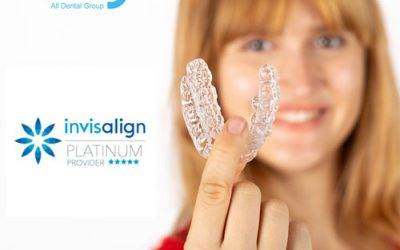 Can I get Invisalign on top teeth only?