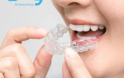 Do you have to wear a retainer forever after Invisalign?
