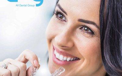 Overcoming Dental Issues with Invisalign – A Journey of Smiles Reclaimed