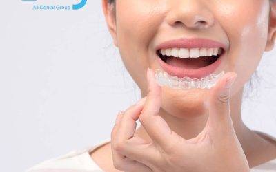 Transforming Smiles and Halting Teeth Grinding