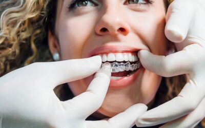 When Will You Feel the Most Discomfort with Invisalign?